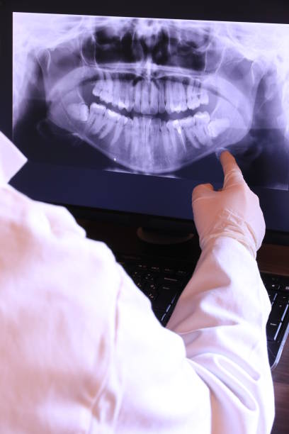 Best Emergency Treatment for Oral Infections in Fort Meade, FL